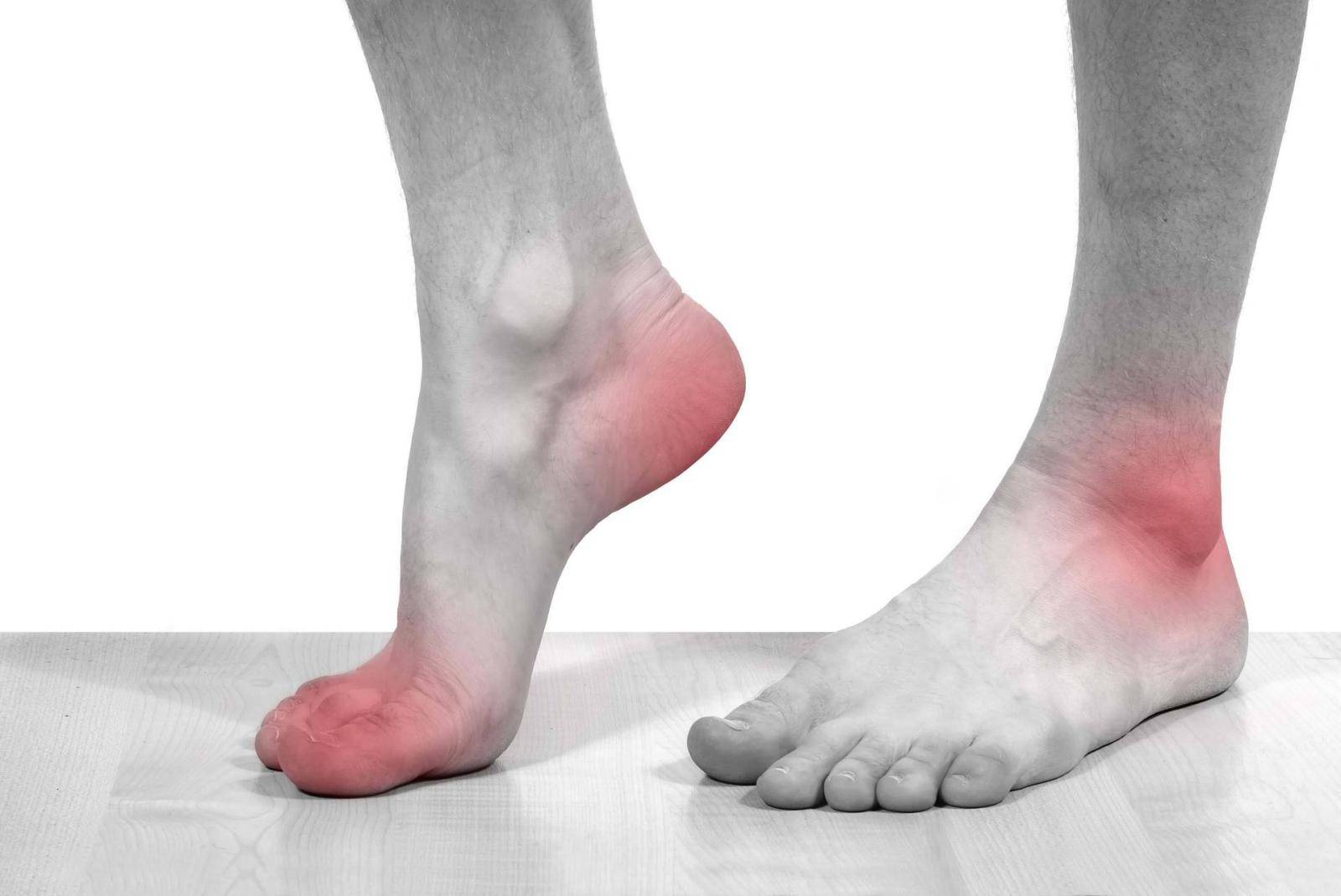 Pronation und Supination des Fußes. Was ist das und wie ist es definiert?