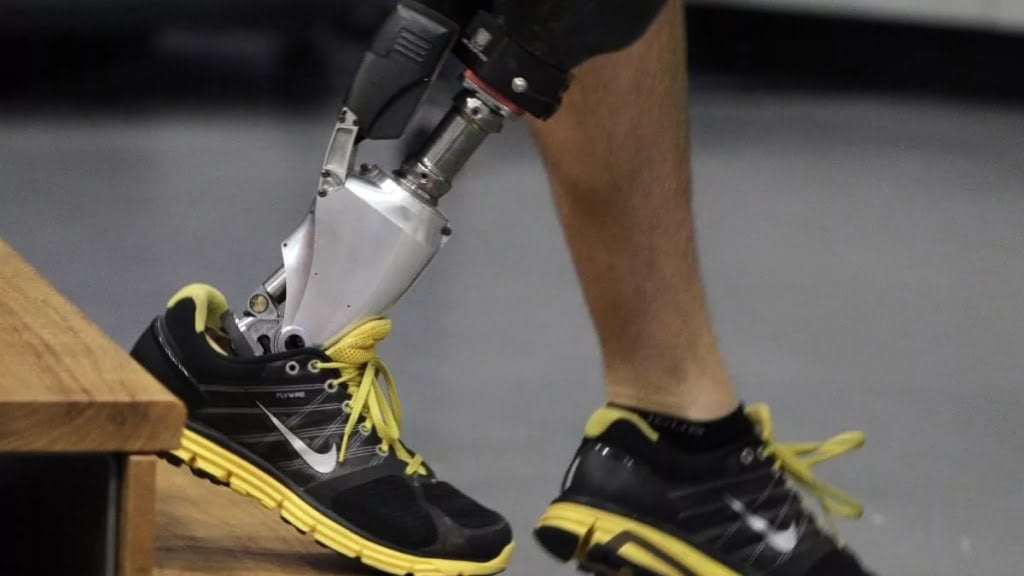 Amputated leg
