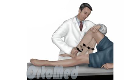 Diagnose von Meniskusverletzungen