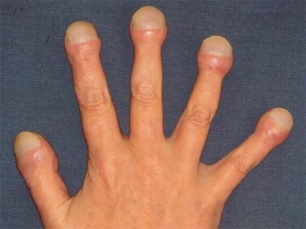 Finger in Form von Trommelstöcken