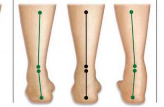 Kurzhantelheben mit Supination