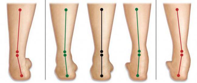 Kurzhantelheben mit Supination